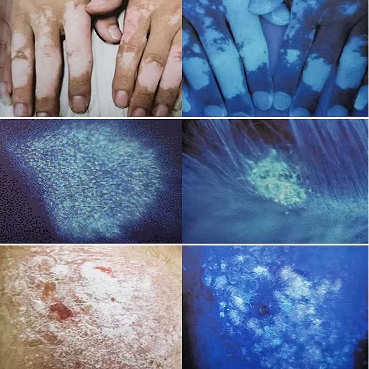 SkinReveal Light